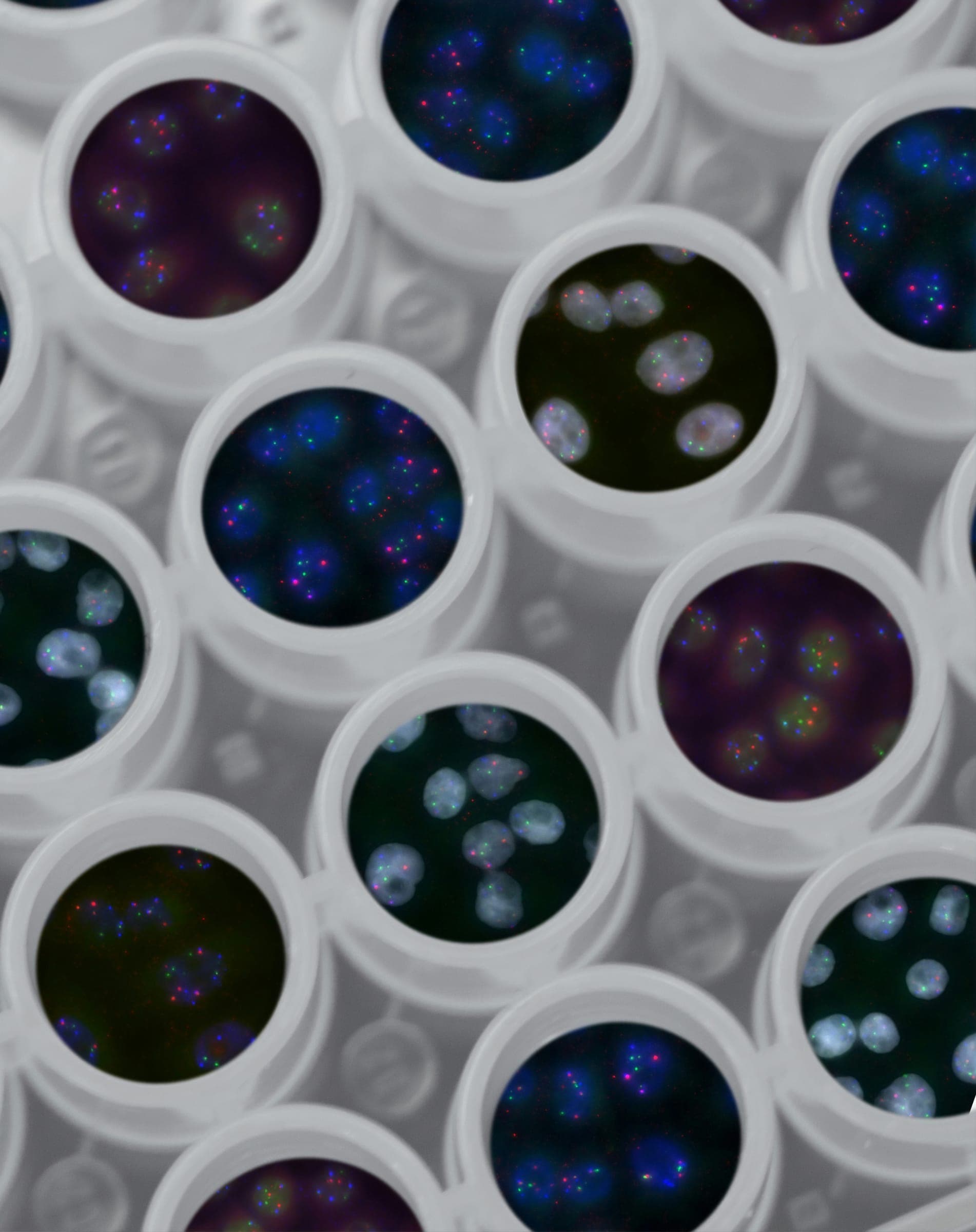 Gut microbiome testing and analysis - petri dishes showing bacterial cultures