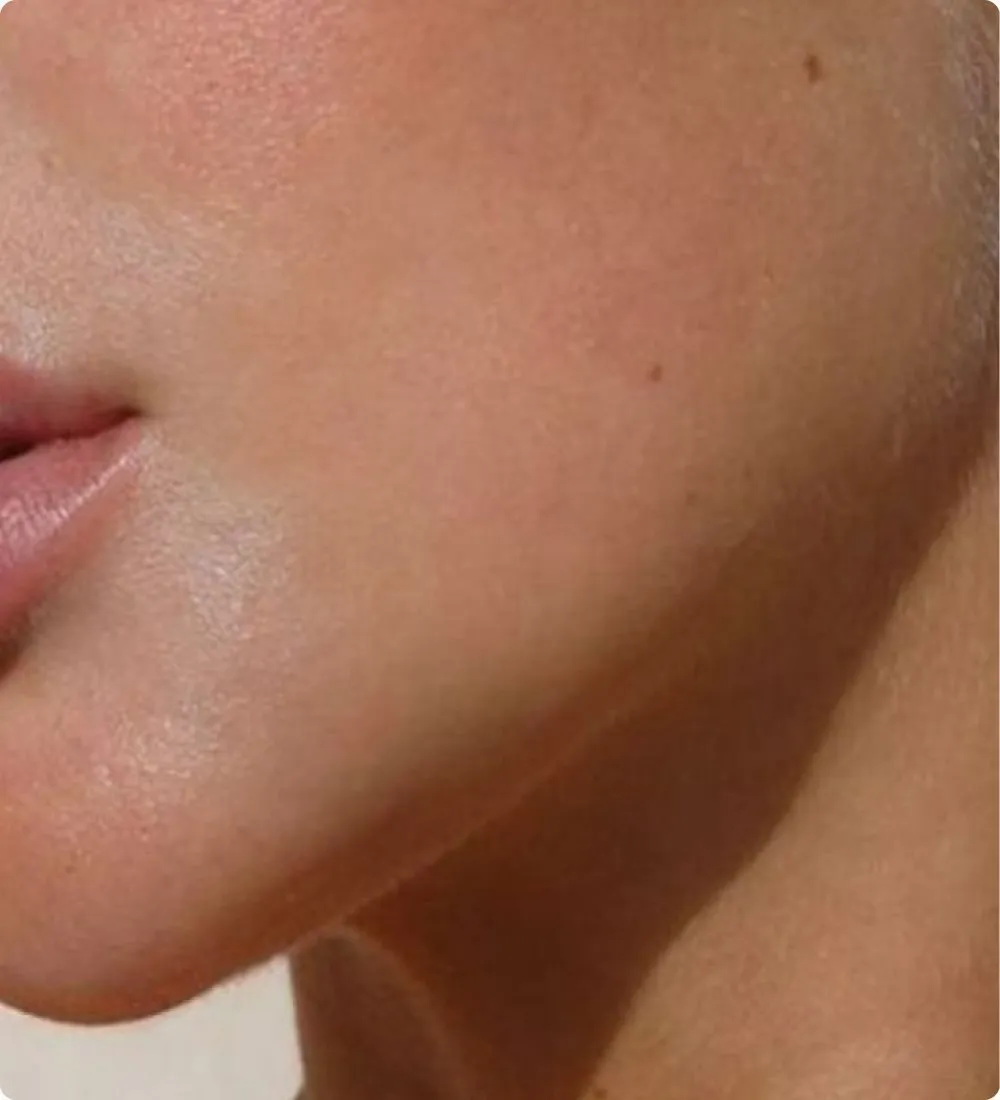 Close-up of the skin of a cheek in soft light